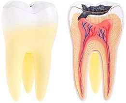 Dental Abscess | Dentist West Ryde