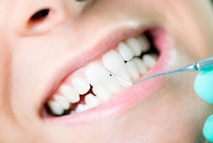 My Local Dentists West Ryde Gum Disease Treatment | Dentist West Ryde