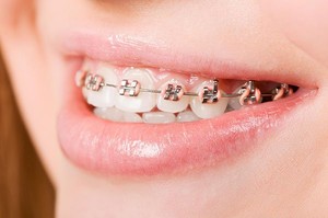 My Local Dentists West Ryde Orthodontics | Dentist West Ryde