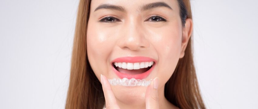 invisalign vs braces west ryde