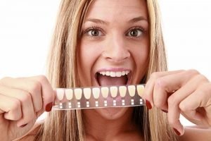 Dental Veneers | Dentist West Ryde