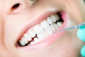 West Ryde Dental Gum Disease Treatment | Dentist West Ryde