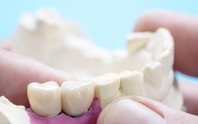 Do “Permanent” Dental Crowns Last Forever?