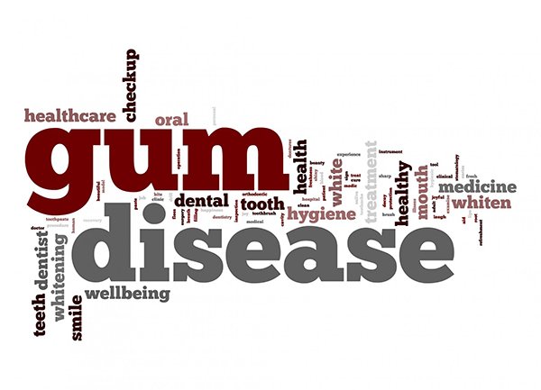 Prevention and Treatment of Gum Disease At My Local Dentists West Ryde