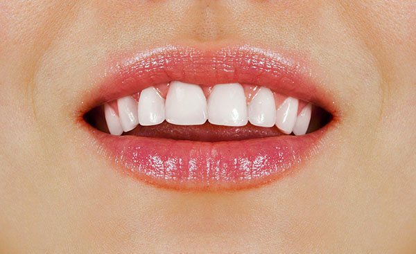 6 Tips To Keep For Healthy White Teeth In West Ryde