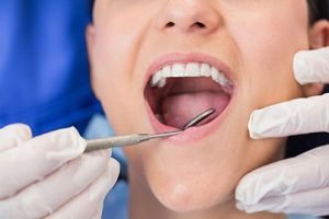 Preventative Dentistry | Dentist West Ryde